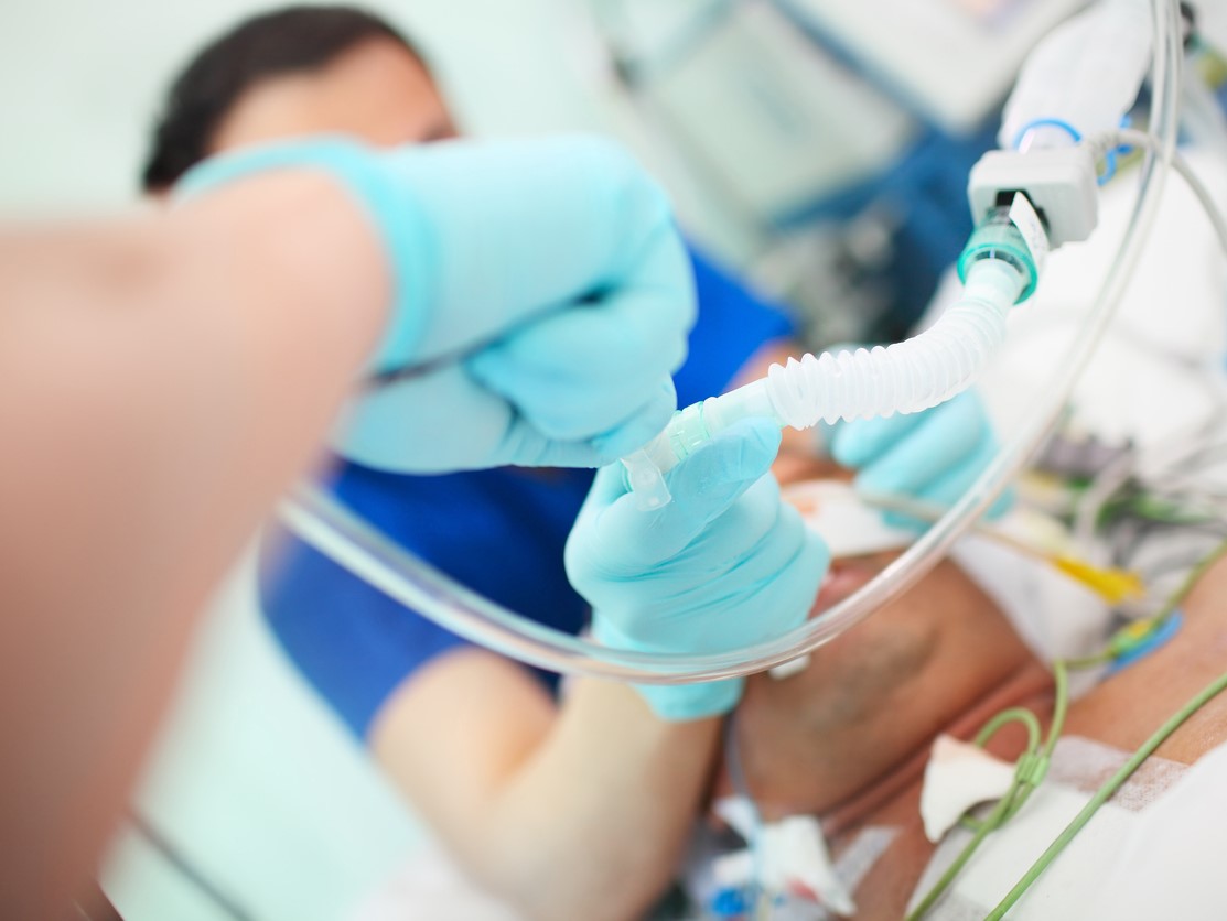 CIDRAP's tweet image. Study shows outsized #COVID19 impact on community hospitals

Central line-associated bloodstream infections, ventilator-associated events, and C difficile infections all increased, esp in smaller hospitals

cidrap.umn.edu/news-perspecti…

#HAI #CLABSI #Cdifficile