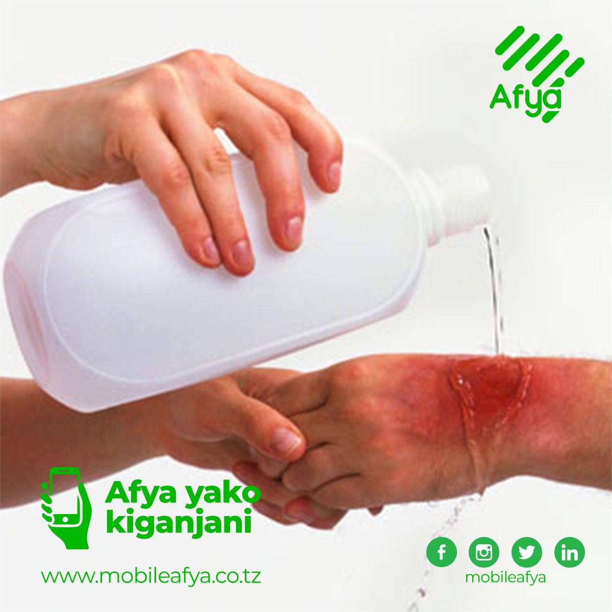 mobileafya's tweet photo. Umeshawahi kupaka asali ukiungua sio?
Ikitokea umepata jeraha dogo la moto, mwagia jeraha maji baridi ili kupooza na kusafisha ngozi na kupunguza maumivu.
Epuka kuingiza jeraha kwenye maji baridi, unaweza kushusha joto la mwili kiasi cha kuhatarisha maisha. #MobileAfya https://t.co/RX6zHLkZD4