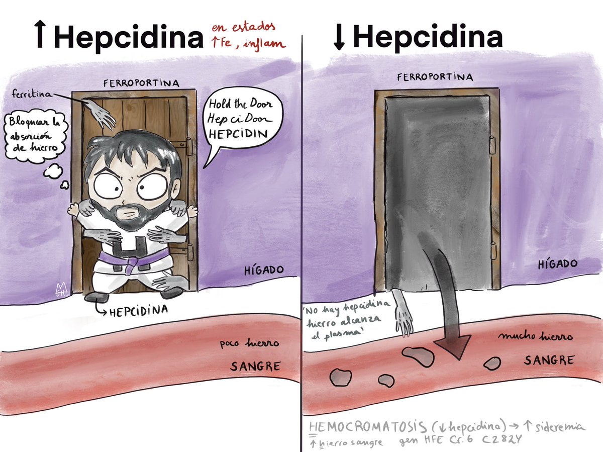 med7drawings's tweet photo. ▪️Mucho hierro en sangre/ inflamación -> AUMENTA HEPCIDINA. Impide que el hierro salga del hígado y por lo tanto disminuye la absorción del hierro. 
▪️DISMINUYE LA HEPCIDINA (ej: hemocromatosis) no hay nadie que impida la salida del hierro y se produce una sobrecarga de hierro. https://t.co/JLZgGQgafP