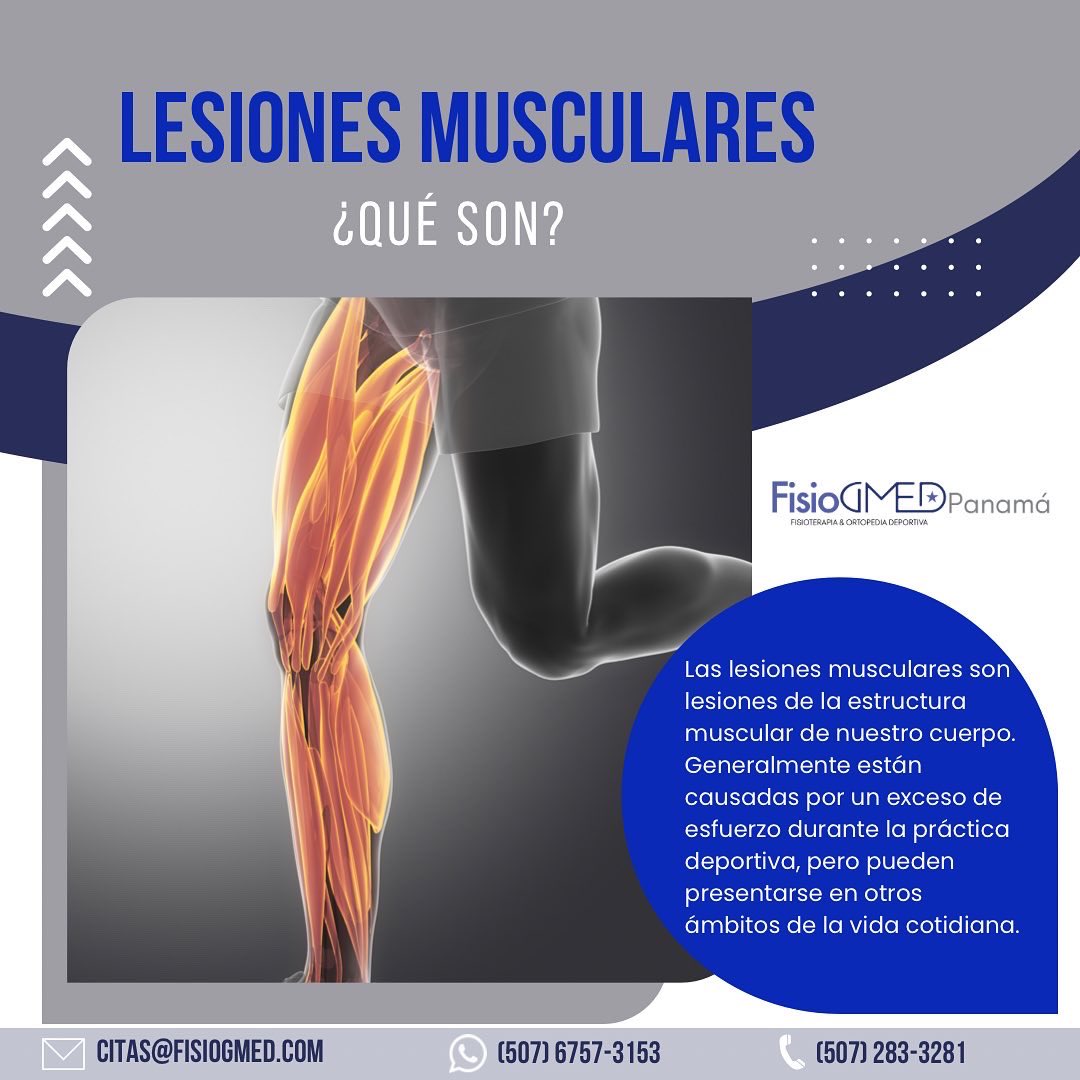 fisiogmed's tweet photo. Las lesiones musculares son lesiones de la estructura muscular de nuestro cuerpo y están causadas por un exceso de esfuerzo durante las prácticas deportivas, pero pueden presentarse en otros ámbitos de la vida cotidiana.
Pueden producirse en todas la fibras o parte de ellas. https://t.co/Z8hsBaVzvl
