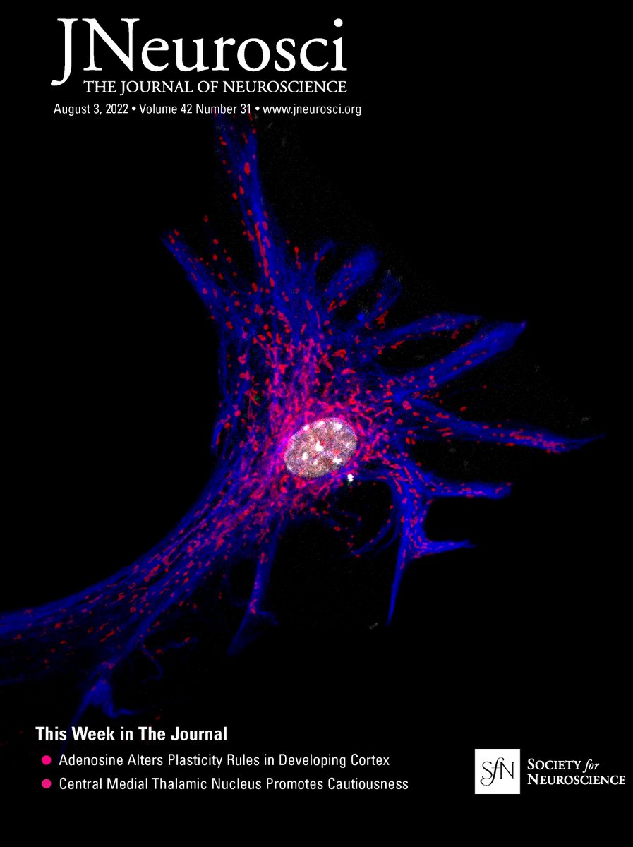 Researchers Rob Cowan &amp; <a href="/NeuroDanielle/">Danielle DeSouza</a> with colleagues at Univ of Maryland, published a study in <a href="/SfNJournals/">SfN Journals</a> identifying distinct subgroups within the migraine population which may lead to novel biomarkers &amp; more patient-centered treatment strategies.  jneurosci.org/content/42/31/…
