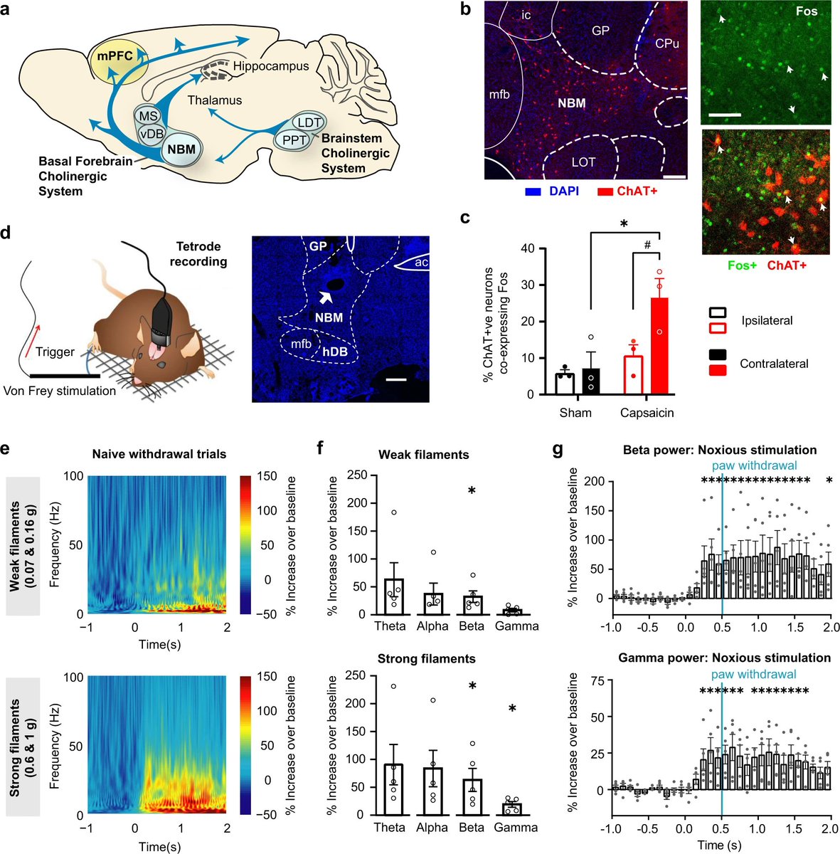 Sam_Brains's tweet photo. Check out our recent paper in @NatureComms🎉!
We used in-vivo #tetrode recordings, #Optogentics, #DREADDs, #cFos IHC and #behavioural tests to study the involvement of NBM #cholingeric neurons in pain #top_down processing in different pain models!
https://t.co/0CzhriO2lH https://t.co/pkzW1I2QyJ