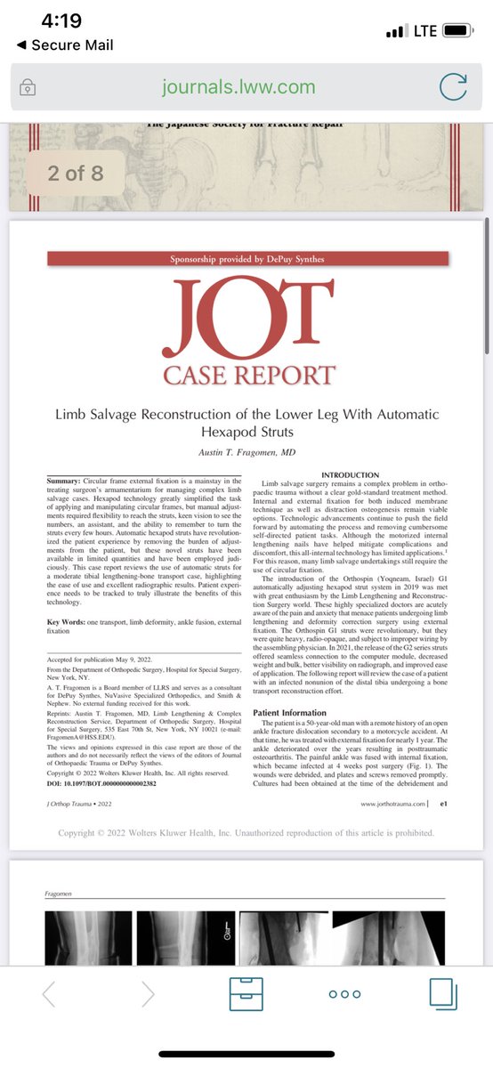 This fun little ditty was recently published on AUTOSTRUT. Patients don’t need to look at their frame anymore! (This innovation aligns perfectly with the WALL-E vision of mankind’s future-joke) urldefense.com/v3/__https://j…$