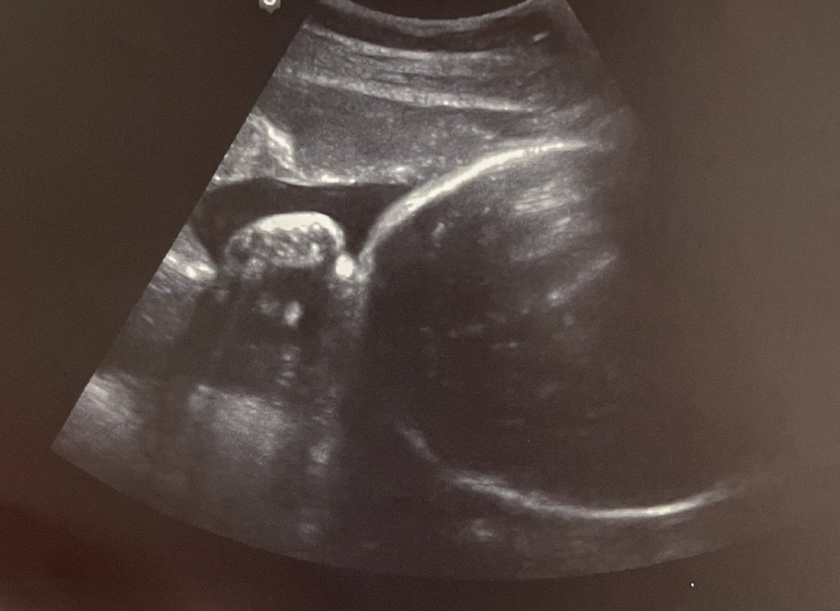 Going to be minting a new bear tonight (sooner than we thought)