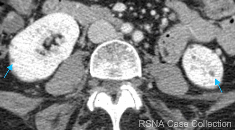 RSNACaseCollection_Editor tweet media