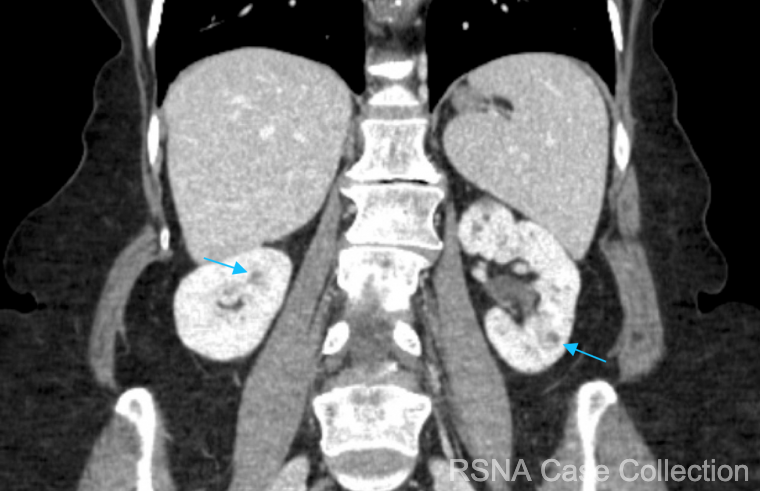 RSNACaseCollection_Editor tweet media