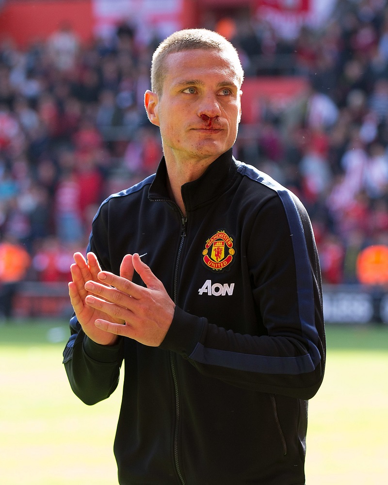 LMDFoot_'s tweet photo. Nemanja Vidic : "Tu peux réparer un nez cassé. Par contre, si tu laisses marquer ton adversaire, tu ne pourras jamais réparer ta fierté". https://t.co/zCbEcTkC1B
