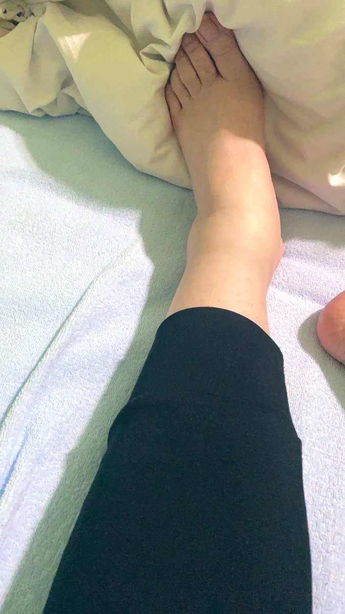 あしが浮腫みすぎ、

あしの付け根も。

利尿剤のんでるなに、、
痛いなあ