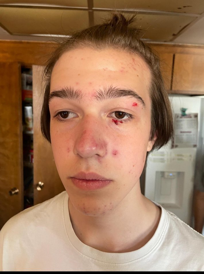 Got fucking punched in the face at school today. How was your day?