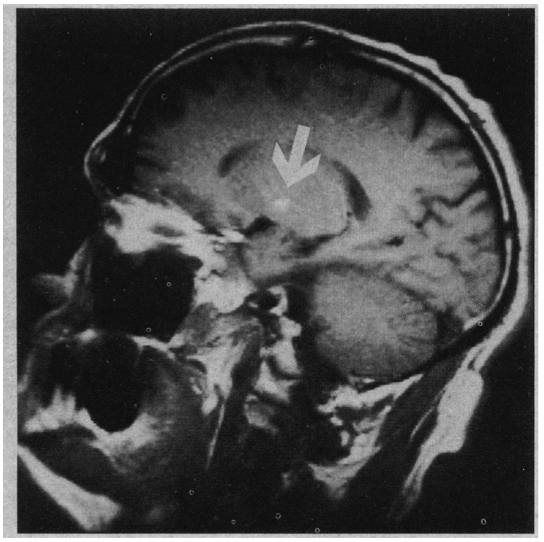 How do we obtain motivation? Where do we store it in our brain? Find out in my entry on #SciFact on my series #ScienceOfProductivity. 

#scicomm
#Neuroscience 
#TLDR
#brain #motivation 

scifact.home.blog/2020/06/17/the…