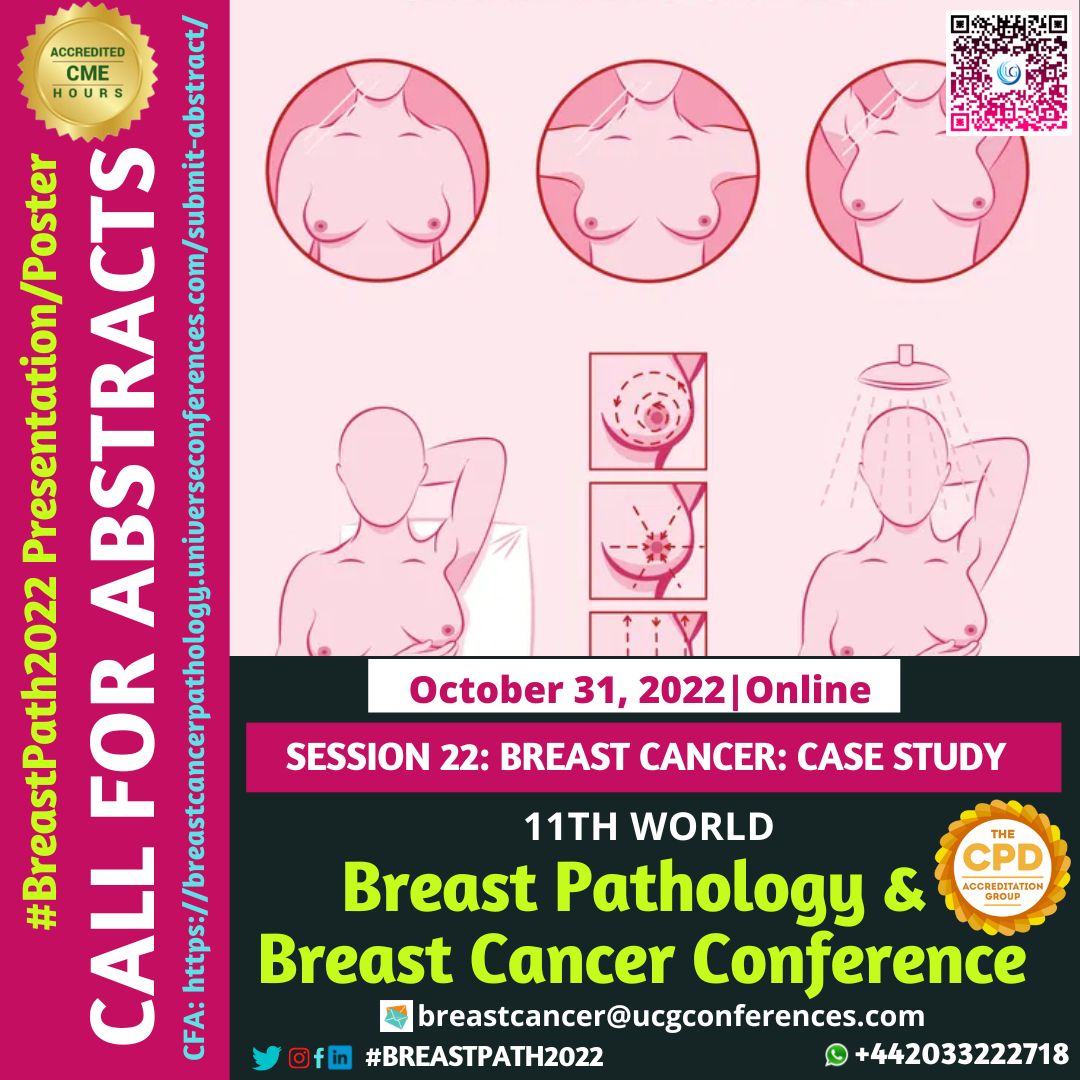 breastcanucg's tweet photo. Track 22: Breast Cancer: Case Study:-
We are ecstatic to be able to provide a forum for those who want to alter the scientific community. On Oct31, 2022, #11thBreastPath2022.
Submit paper: https://t.co/JFa0wbFAln
#乳がんの専門家 #DEFINISIPENGOBATANEFEKTIF #ڪينسرجياثرائتيماهر https://t.co/PluhA125IY