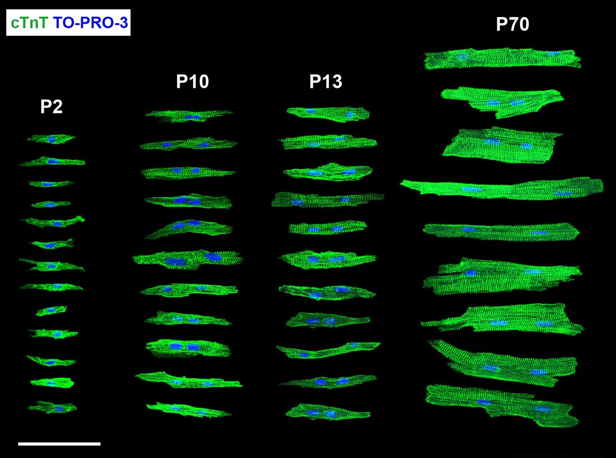Dr. Amy Nicks (@amynicksphd) on Twitter photo Excited to share my work!! A how-to guide for isolating high quality #cardiomyocytes from neonatal through to adult #hearts 🫀. Look at these beautiful #cells - perfect for morphological and molecular characterisation🔬! <a href="/JMCCardiology/">Journal of Molecular and Cellular Cardiology</a> <a href="/VictorChangInst/">Victor Chang Cardiac Research Institute</a> bit.ly/3Cypcrf Excited to share my work!! A how-to guide for isolating high quality #cardiomyocytes from neonatal through to adult #hearts 🫀. Look at these beautiful #cells - perfect for morphological and molecular characterisation🔬! <a href="/JMCCardiology/">Journal of Molecular and Cellular Cardiology</a> <a href="/VictorChangInst/">Victor Chang Cardiac Research Institute</a> bit.ly/3Cypcrf