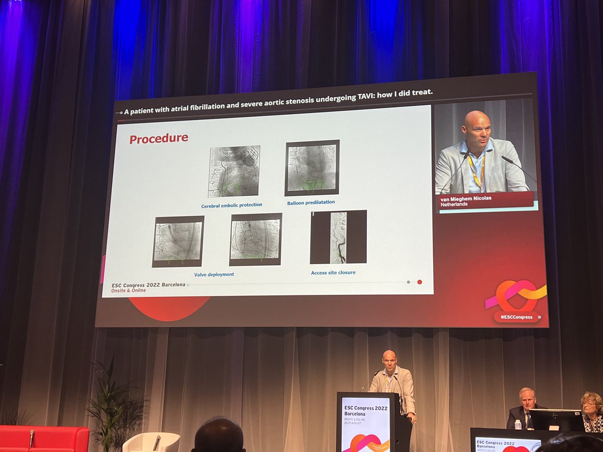 KardiologieHH's tweet image. 5/ A patient with atrial fibrillation and severe aortic stenosis undergoing TAVI: #HowIdidIt!
by @drnvanmieghem

#ESCcongress 

@mirvatalasnag @franzone_anna