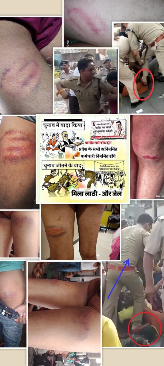 प्रशासनिक गुंडागर्दी की बात निकली तो बात दूर तक जाएगी साहब इसलिए सोच पुलिस को मोहरा मत बनाईये मुद्दे और अधिकार पर बात कीजिए?? <a href="/bhupeshbaghel/">Bhupesh Baghel</a> <a href="/ChhattisgarhCMO/">CMO Chhattisgarh</a> <a href="/PurandeswariBJP/">Daggubati Purandeswari 🇮🇳</a> <a href="/drramansingh/">Dr Raman Singh</a> <a href="/PawanSaiBJP/">Pawan Kumar Sai</a> <a href="/DrHimanshu73/">DR. HIMANSHU DWIVEDI</a>