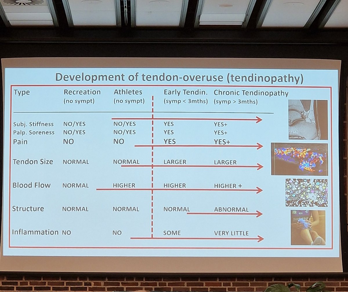 IntFSPT's tweet photo. What is Tendonopathy? Prof Michael Kjaer 

95-97% of tendon matrix made during growth

3-5% is constantly renewed through life 

That small % may be hugely important 

Mechanical load is critical 

#WCSPT2022 https://t.co/87TIiAPZ7r