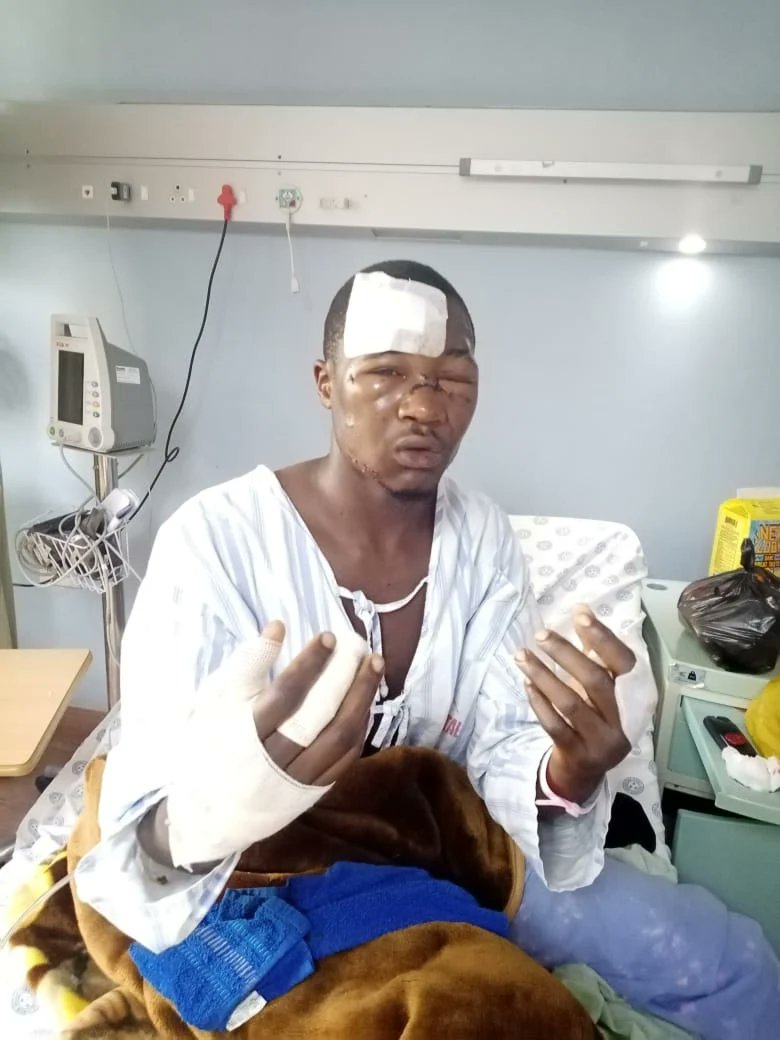 KasiEconomy's tweet photo. This South African man Ndumiso Mona fought with a leopard and killed it with his own bare hands. This comes after the leopard escaped from the Kruger National Park.

 He says "I stared death in the eyes. ready to punch like a boxer. I told myself one of us had to die." https://t.co/2HHUYz8qH7
