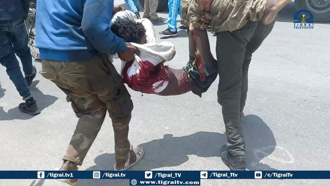 BashaDesta's tweet photo. Breaking!

The fascist Gov't of Ethiopia has killed children and many innocent people in an airstrike on a kindergarten in Mekele city today. Many were also injured. We urge the International Community to know and condemn this clear genocidal attack!
@UN @hrw @amnesty @PowerUSAID https://t.co/wiYGz6dOpq