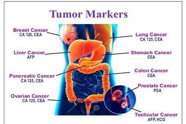 godmah86's tweet photo. ابرز ال Tumor Marker https://t.co/9FuCsL73YK