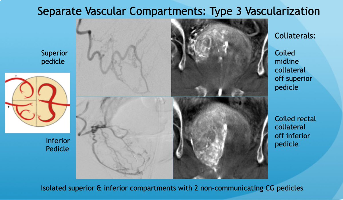jdemeritt's tweet photo. @AriIsaacsonMD @SIRRFS @SIR_ECS @IR_juniors @CAIRweb https://t.co/w6Oc4ttgaK