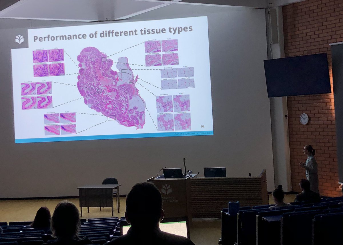 PasonenSanna's tweet photo. Great talk @SonjaKoivukoski about unstained tissue imaging and virtual HE staining in the #UEFwinterschool @UEF_DPMM @UEFcancer https://t.co/PgpKzVmwPA