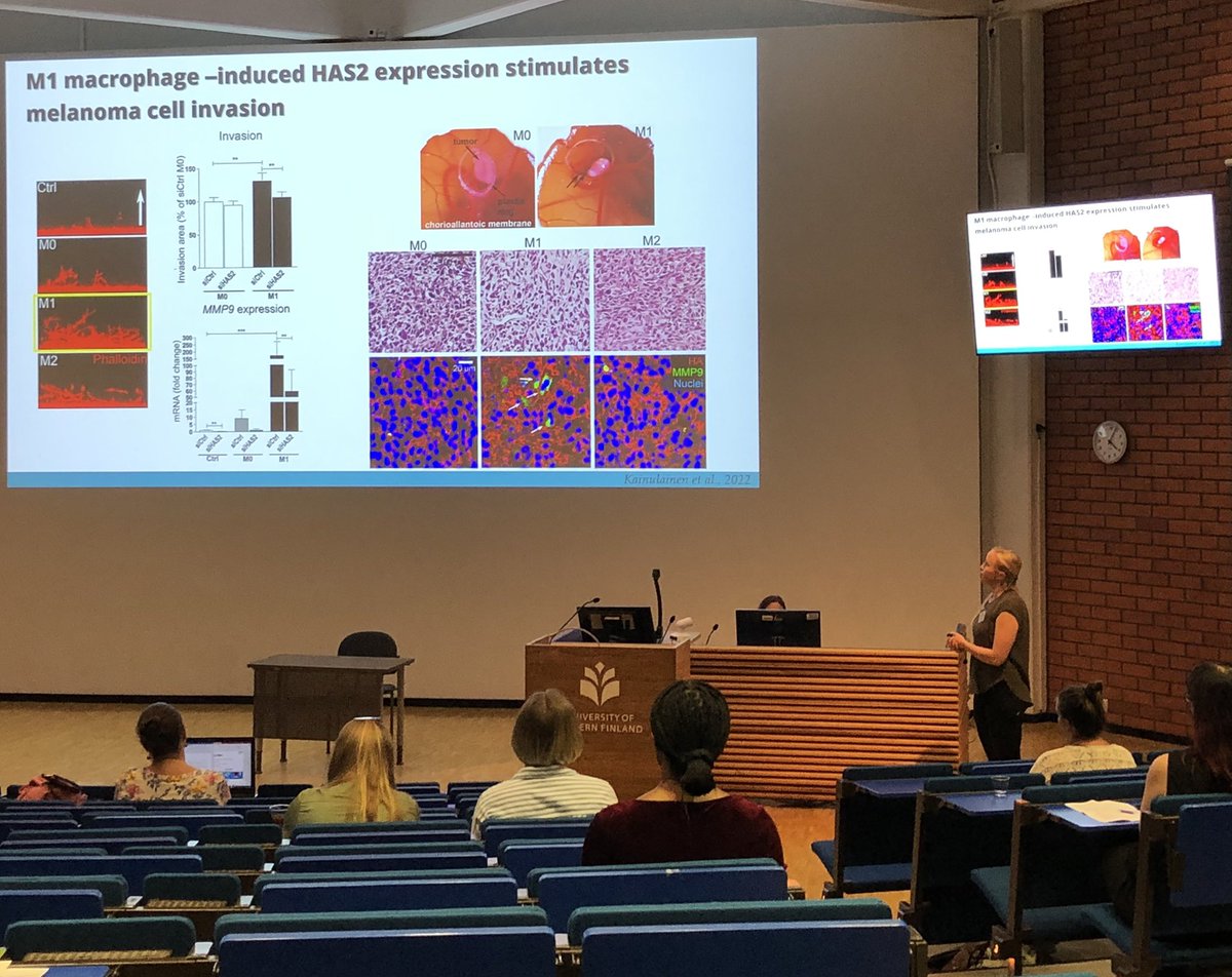 PasonenSanna's tweet photo. Interesting data related to #inflammation - protumor inflammation in melanoma, EVs in inflammed liver, anti/inflammatory signaling by @KirsiKainulain @JMMatilainen and Velidendla Bharadwaja in the #UEFwinterschool @UEF_Biomed @UEF_DPMM https://t.co/z9zaDOVFOP