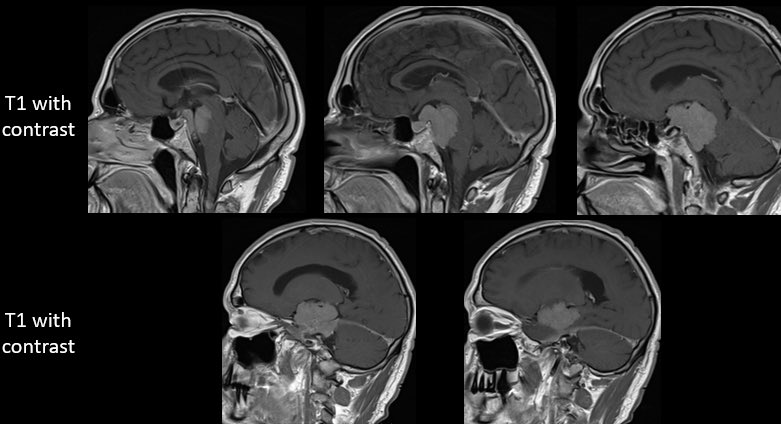Jacques Morcos MD FRCS FAANS tweet media