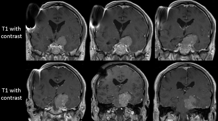 Jacques Morcos MD FRCS FAANS tweet media