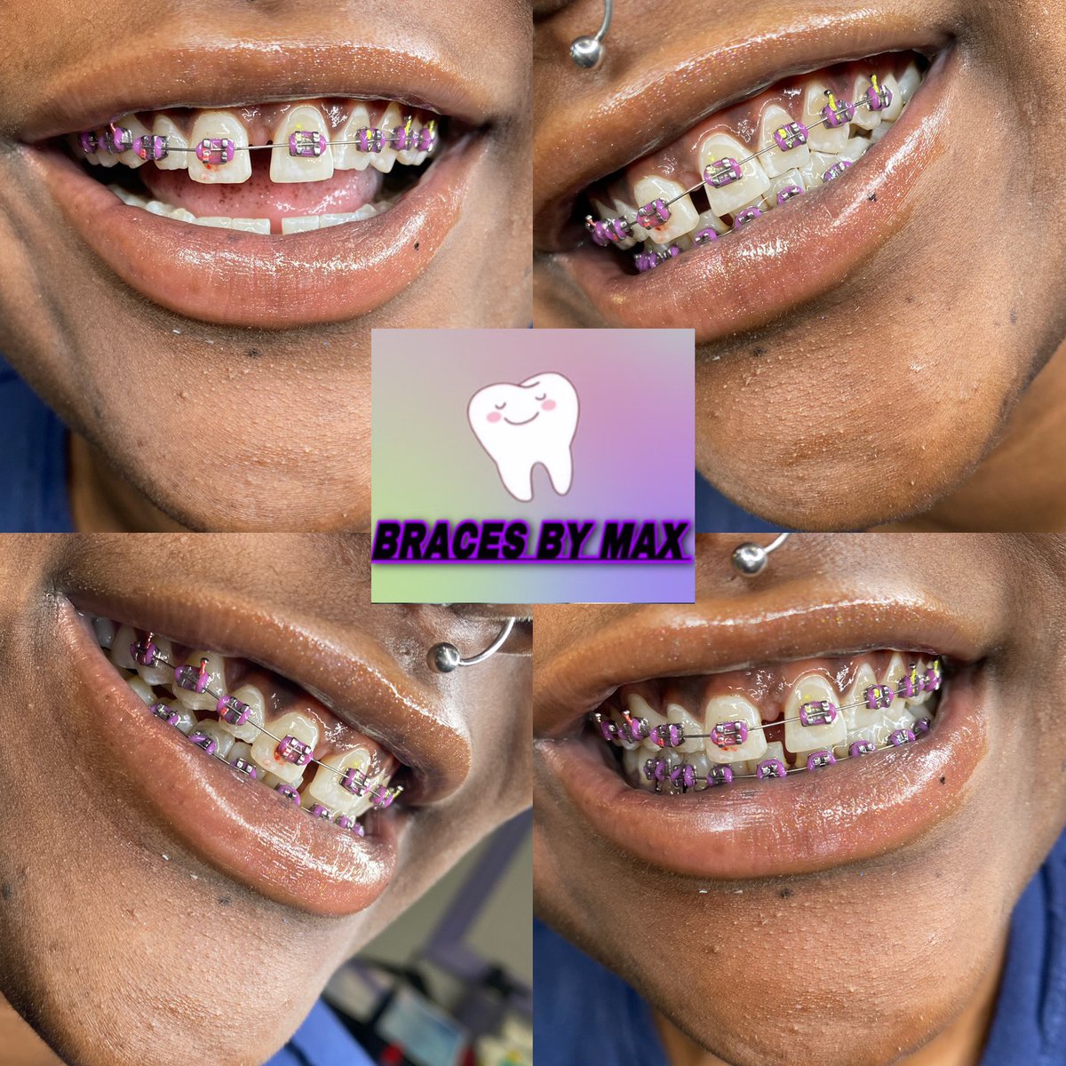 MaxiiMaxee's tweet image. I do braces , nails , piercings &amp;amp; makeup YALL go support my regular business too !!! @LifeAsMaxi1 ‼️❤️🗣📣