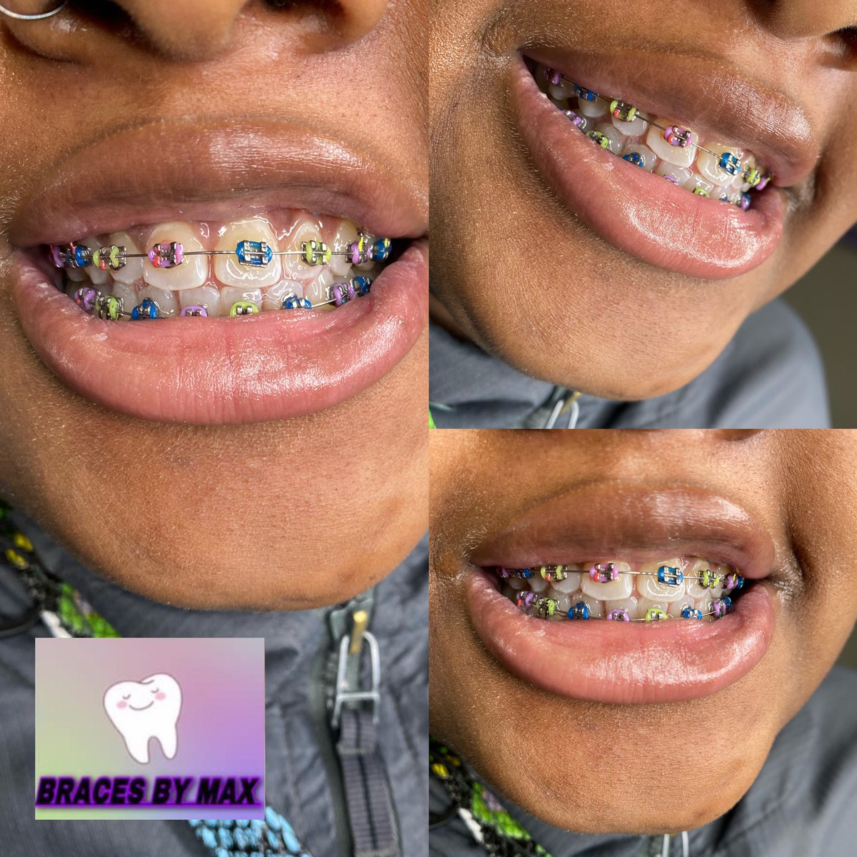 MaxiiMaxee's tweet image. I do braces , nails , piercings &amp;amp; makeup YALL go support my regular business too !!! @LifeAsMaxi1 ‼️❤️🗣📣