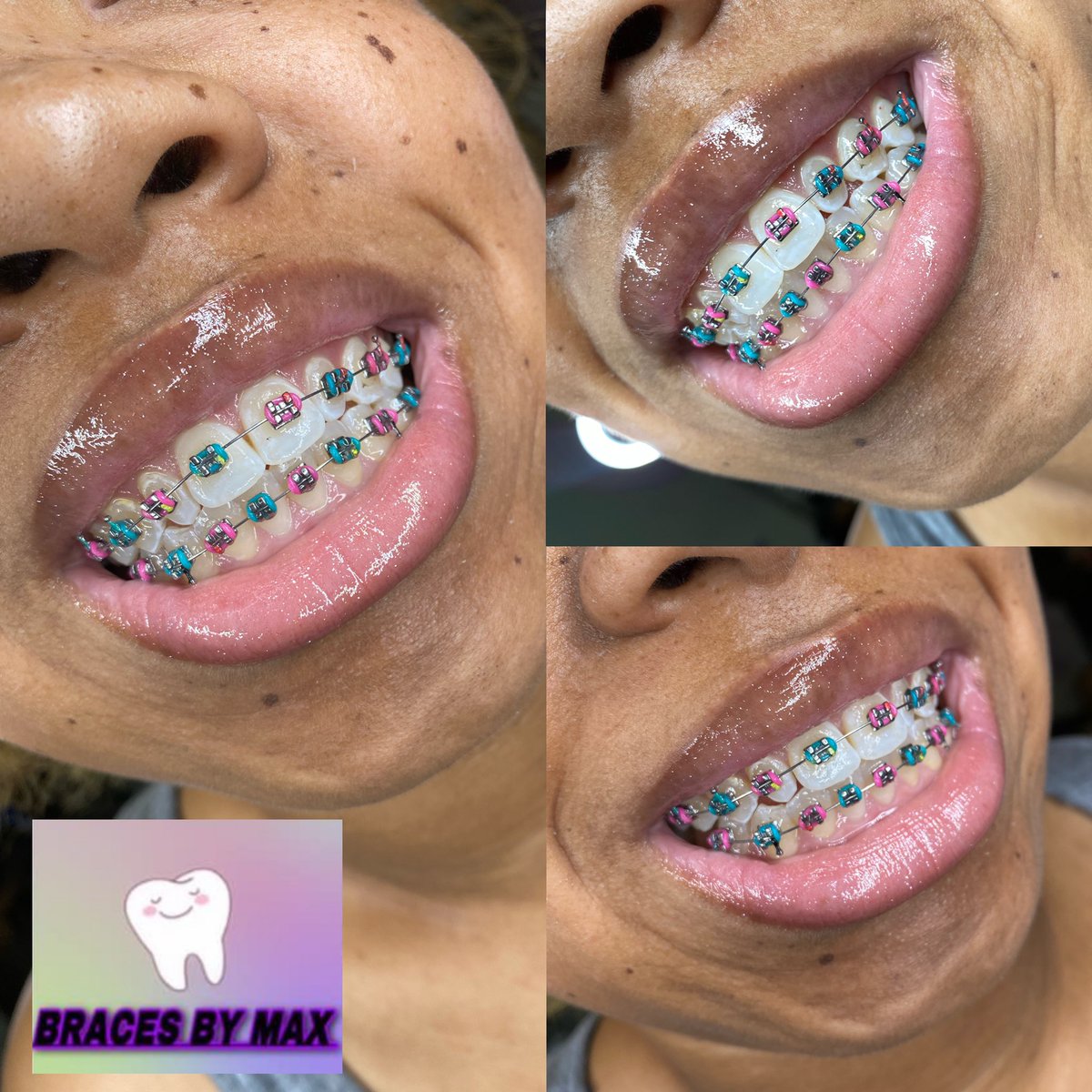 MaxiiMaxee's tweet image. I do braces , nails , piercings &amp;amp; makeup YALL go support my regular business too !!! @LifeAsMaxi1 ‼️❤️🗣📣