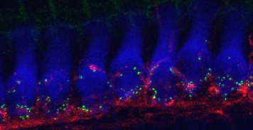 Sheffield Hearing Group tweet media