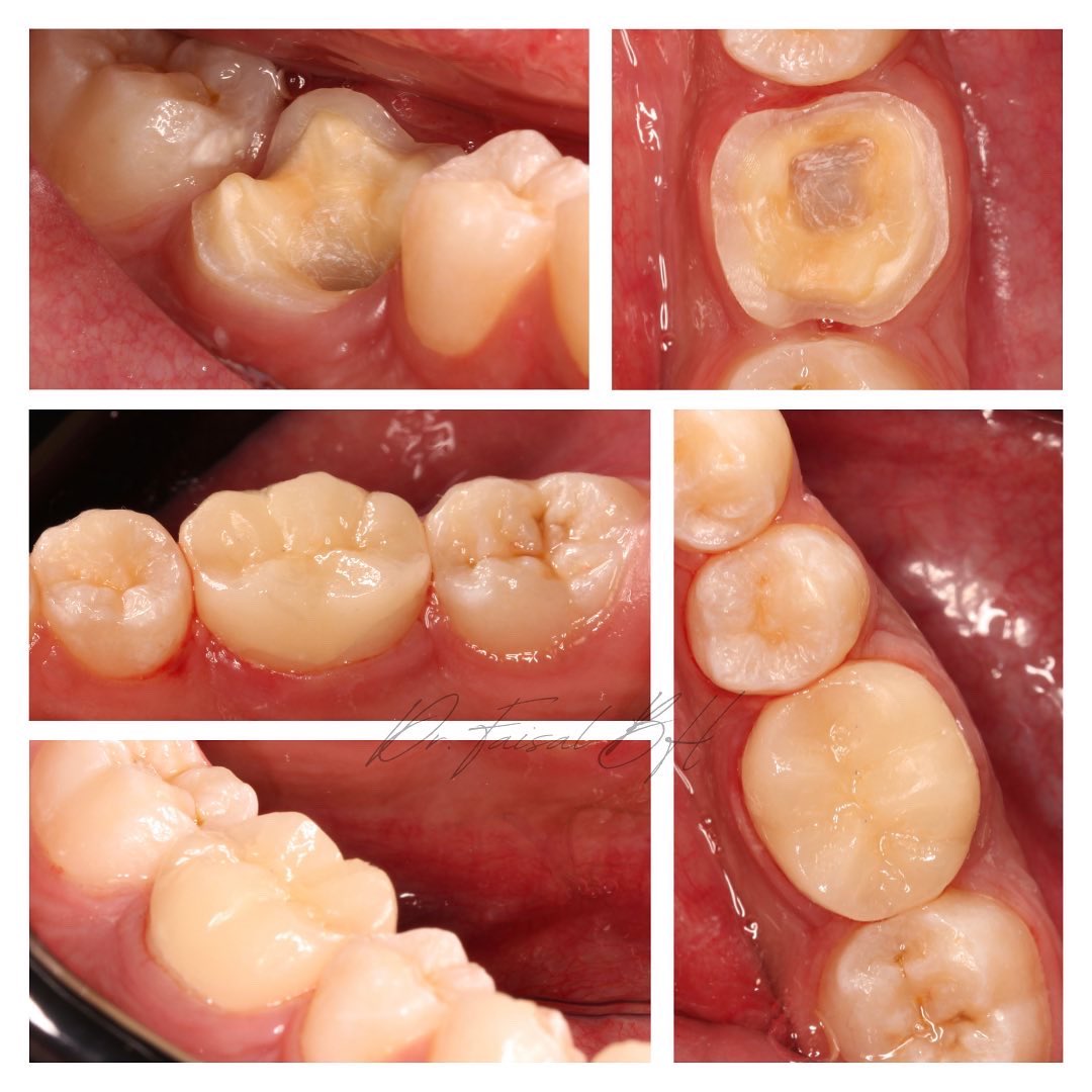 Dr. Faisal Binhassan tweet media