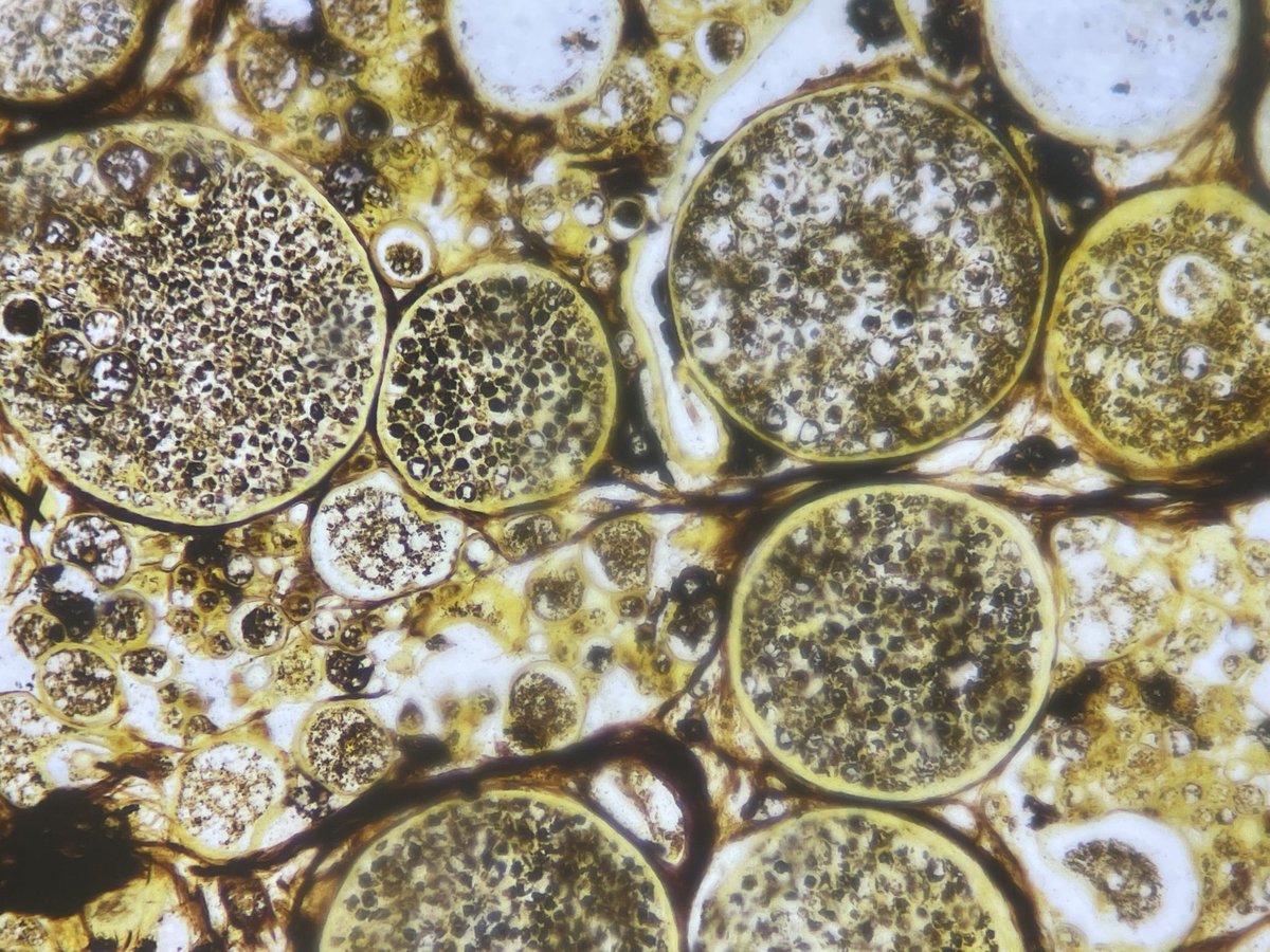 pathologicrain's tweet photo. @smlungpathguy Got the GMS and PASD today https://t.co/ddQoiidGYT