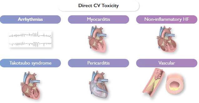 cardioteca's tweet photo. 🚨🆕🔝 4 nuevas Guías ESC 2022! #ESCCongress

🧬 Cardio-oncología
https://t.co/CSSpjpUxNn

💔 Arritmias ventriculares y muerte súbita cardiaca
https://t.co/L6EjeZNeeE

🌬️ Hipertensión pulmonar
https://t.co/JXH7TK7ukT

🛏️ Manejo CV Cirugía no cardiaca
https://t.co/wRRBOQn0So https://t.co/ohRTC8Td6M