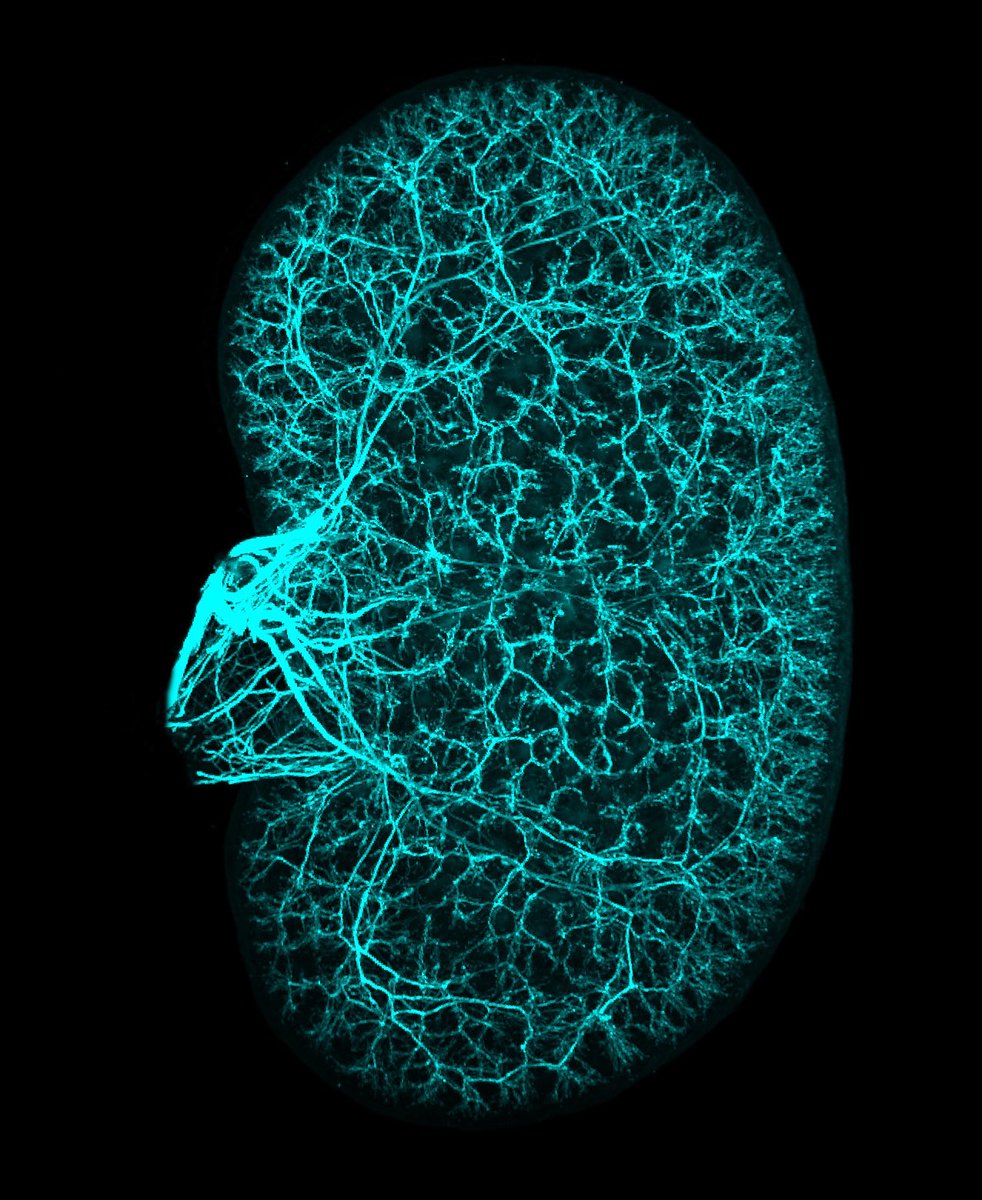 l_obrien_lab's tweet photo. It’s impressive how extensive kidney innervation is even at this early postnatal stage (P7, Tuj1 labeling). I think there is a lot yet to uncover about their contributions to health and disease. #FluorescenceFriday @P_NGUETTA image credit https://t.co/Xr9zlR4WCJ
