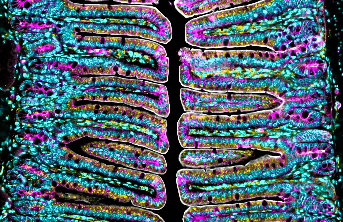 AmyEngevik's tweet photo. #FluorescenceFriday featuring small intestinal villi. 

#bioart #sciart #pathart #histoart #microscopy #sciencetwitter #GItwitter https://t.co/c8NDiGMRYf
