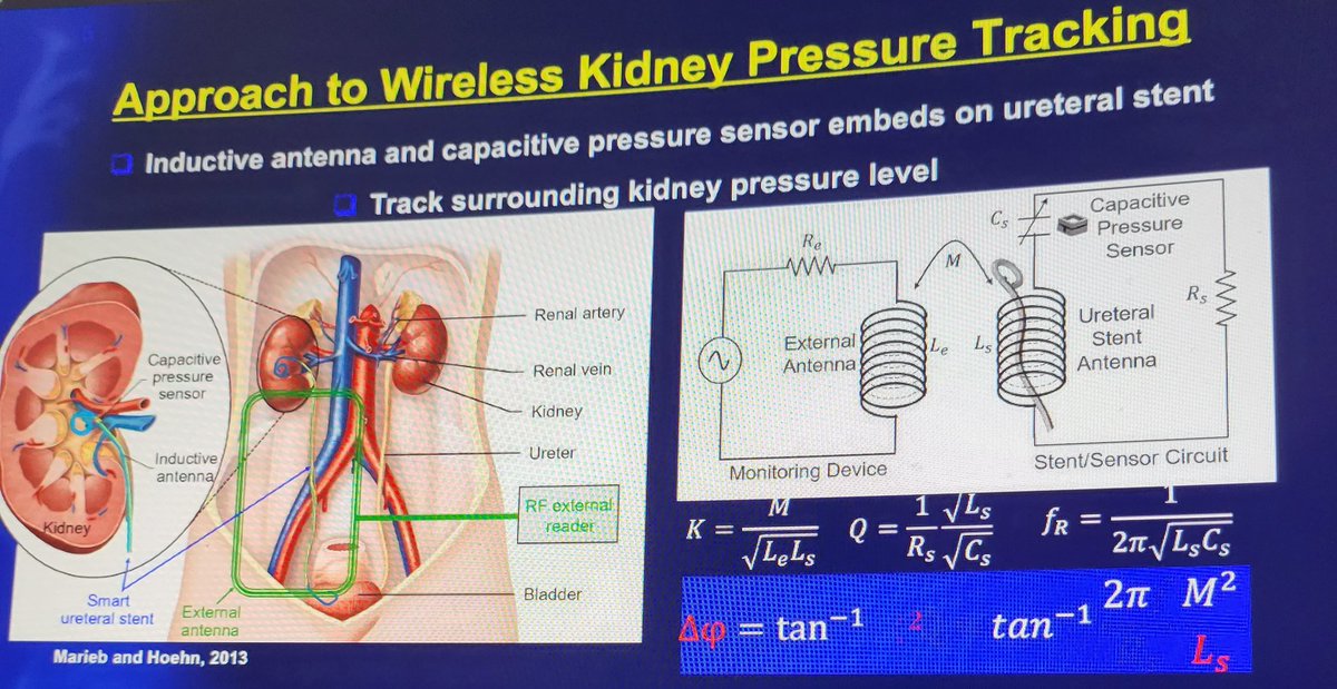 DocGauhar's tweet photo. @DrBenChew @StefaniaFerret @peepeeDoctor
#webinars still attract big audience
Kudos/outstanding talks 🙏@rocamed
#Endourology innovations 👍👍
grateful to share the podium #JFil #miniJFil
@MUSICUrology @CanUrolAssoc @Endo_Society @docmeetings @Uro_News @urotoday @PETRAurogroup https://t.co/SlvUiw5IlO