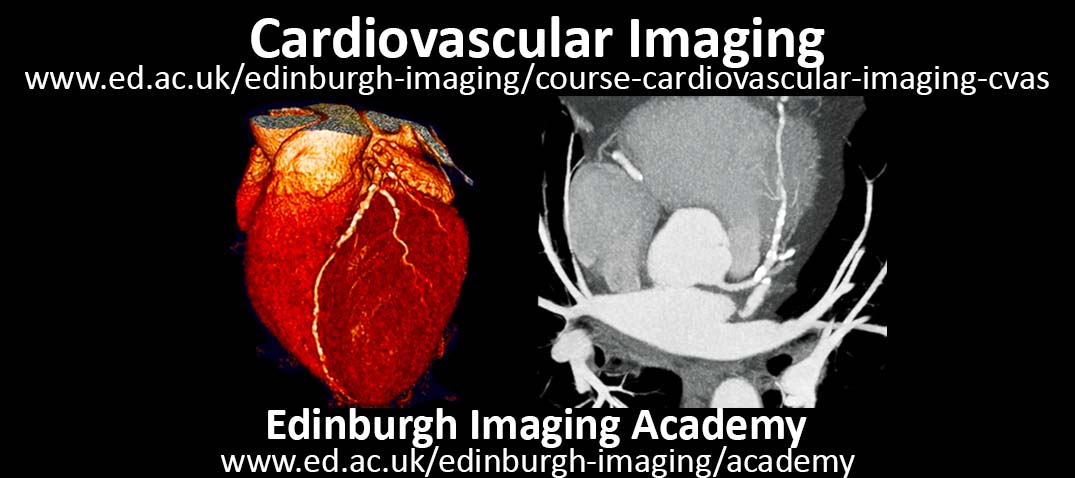 Edinburgh Imaging Academy (@edinunineuroimg) on Twitter photo Are you a health professional attending #ESCCongress & wishing to gain further knowledge about heart & blood vessel diseases?
Our online short course in Cardiovascular Imaging can teach you.
Check out our study options: ed.ac.uk/edinburgh-imag…
<a href="/imagingmedsci/">imagingmedsci</a> Are you a health professional attending #ESCCongress & wishing to gain further knowledge about heart & blood vessel diseases?
Our online short course in Cardiovascular Imaging can teach you.
Check out our study options: ed.ac.uk/edinburgh-imag…
<a href="/imagingmedsci/">imagingmedsci</a>