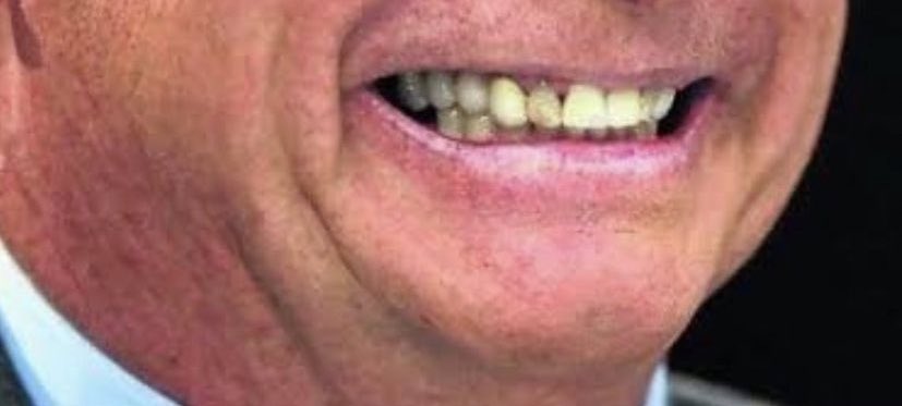 DrHamiltonjr's tweet photo. O cara não arruma nem os Dentes, vai arrumar o Brasil? https://t.co/VhQTWMH8J6