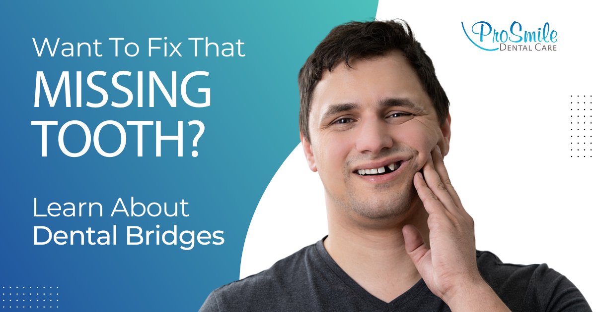ProSmileDental2's tweet photo. Missing teeth? Dental bridges might be just the treatment to restore your bite for a beautiful smile. Keep reading to learn more!

https://t.co/4Qg1Nu4625

#DentalBridge #CosmeticDentistry #DentalProblems #MissingTeeth #DentalCare #SanRamon #DanvilleCA #ProSmileDentalCare https://t.co/cry5MkHFW3