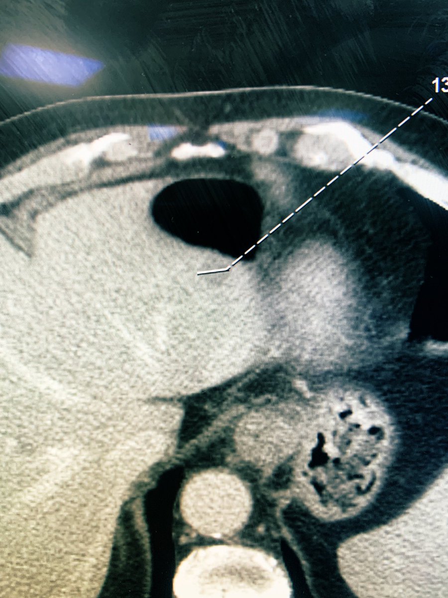 Naif Alsaikhan | د. نايف بن حمد الصيخان tweet media