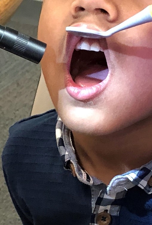 DYK that if your child is in JK, SK or Grade 2, they'll be offered a FREE dental screening at school by a Halton Region Public Health Registered Dental Hygienist this 2022-2023 scholl year? Stay tuned for the details from your child's school.  <a href="/HaltonDSB/">HDSB</a> <a href="/HCDSB/">Halton Catholic DSB</a> ^tk