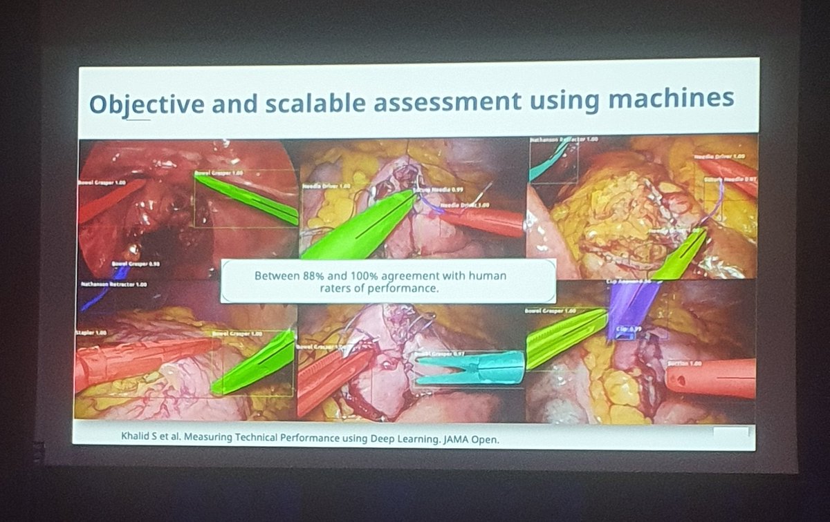 Fascinating talk by @TGrantcharovMD @surgicalsafety about using big data, computer vision, and AI driven solutions to improve intraoperative performance and safety 📊 #NZAGS22 

More on postoperative safety by @drcamwells soon 👀