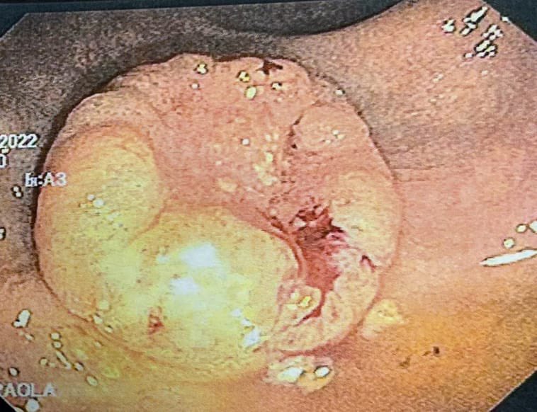 Revista Argentina de Coloproctología tweet media