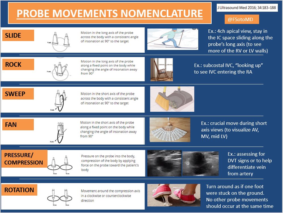 FSotoMD's tweet photo. Use of uniform probe movement nomenclature in #POCUS teaching

#MedTwitter 
#MedEd 
#FOAM https://t.co/Fm3SQbB0IL