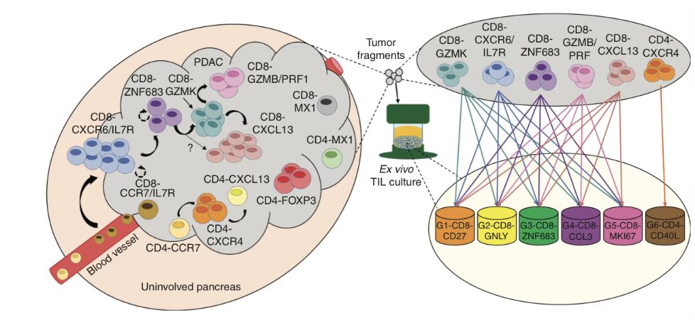 Anirban Maitra (@aiims1742) on Twitter photo ICYMI: Final version of the <a href="/CD_AACR/">Cancer Discovery</a> paper on T cell trajectories in pancreatic cancer is now online. Magnum opus from the <a href="/MDAndersonNews/">MD Anderson Cancer Center</a> #PancreaticCancer #Moonshot team. Single cell RNAseq & TCRseq on 80,000 T cells, treasure trove for mining targets!
aacrjournals.org/cancerdiscover⦠ICYMI: Final version of the <a href="/CD_AACR/">Cancer Discovery</a> paper on T cell trajectories in pancreatic cancer is now online. Magnum opus from the <a href="/MDAndersonNews/">MD Anderson Cancer Center</a> #PancreaticCancer #Moonshot team. Single cell RNAseq & TCRseq on 80,000 T cells, treasure trove for mining targets!
aacrjournals.org/cancerdiscoverā¦