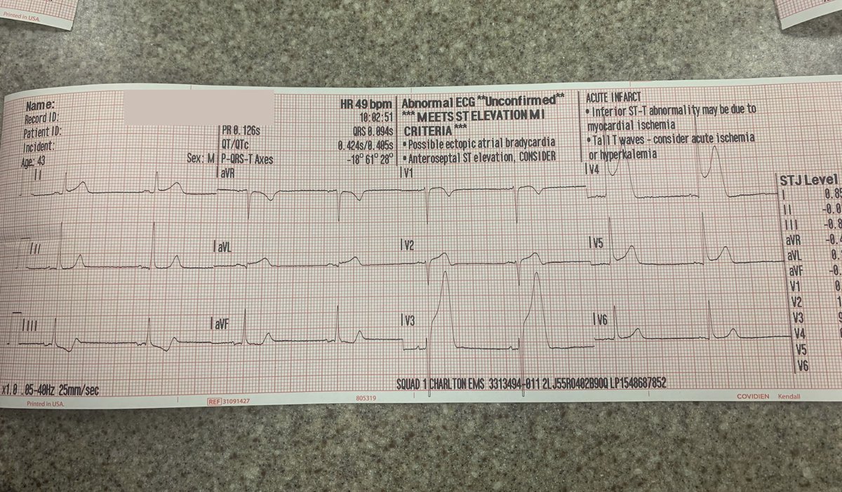 EM_RESUS's tweet image. Patient: “I think it’s just reflux”

Narrator: It was not just reflux