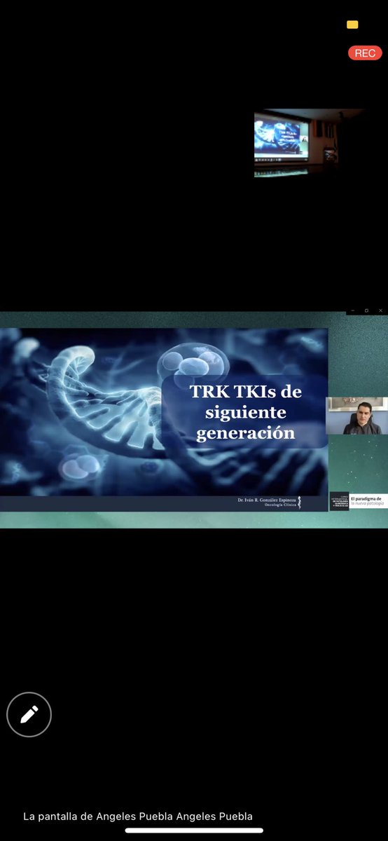 Dr_Ivanoncologo's tweet photo. Primera sesión "FUSIONES DE NTRK, SARCOMAS Y TRATAMIENTO" curso internacional de patología quirúrgica y molecular.

#DrIvanRomaricoGonzalezEspinoza #oncologo #oncologomedico
#drivángonzález #oncologomexico #oncologoenpuebla  #cancersurvivor #cancer #labopat #patologia #patology https://t.co/wYl43BZQVT