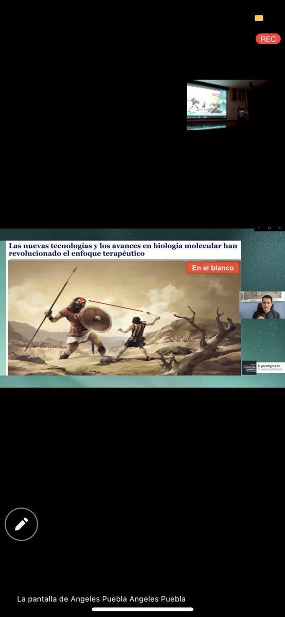 Dr_Ivanoncologo's tweet photo. Primera sesión "FUSIONES DE NTRK, SARCOMAS Y TRATAMIENTO" curso internacional de patología quirúrgica y molecular.

#DrIvanRomaricoGonzalezEspinoza #oncologo #oncologomedico
#drivángonzález #oncologomexico #oncologoenpuebla  #cancersurvivor #cancer #labopat #patologia #patology https://t.co/wYl43BZQVT