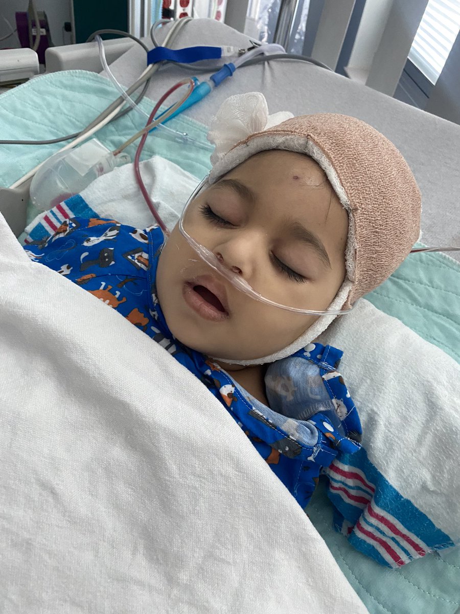 Gustavo8_'s tweet photo. Ahora solamente tiene un hemisferio derecho y una cavidad vacía en su otro lado. Debido a la complejidad de la cirugía y lo que implica quitar la mitad de su cerebro, Giulia estuvo sedada durante los 2-3 primeros días. Abría los ojos por segundos y volvía a dormir. También tenía https://t.co/S6qzeFC9Od